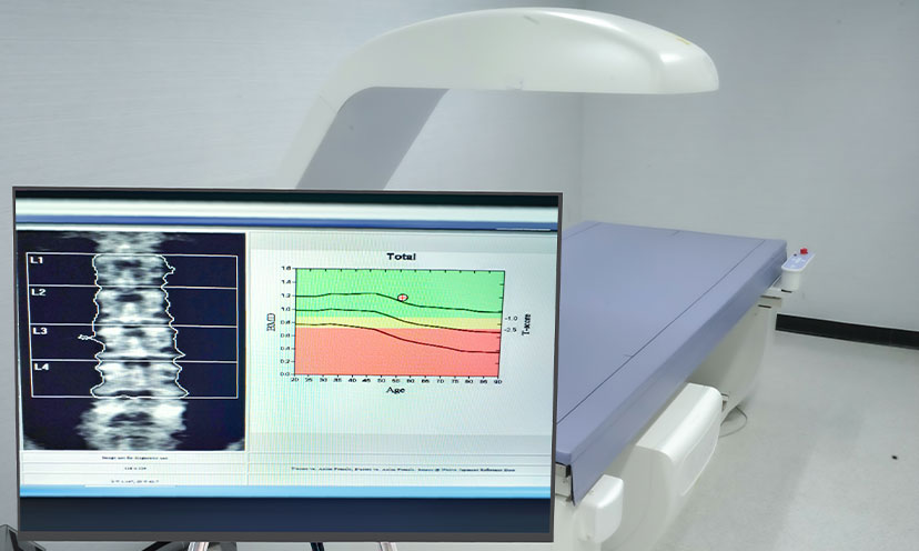 Image showing content related to bone